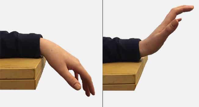 physical therapy wrist